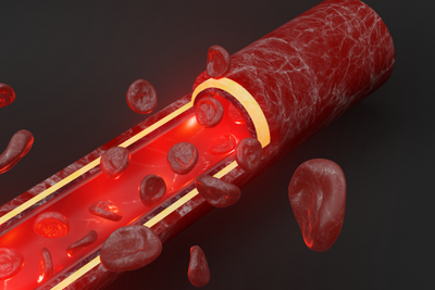 Capillaroscopia Raynaud: uno strumento diagnostico fondamentale